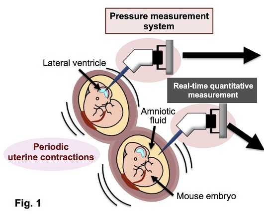 Revealing the Pressure Environment surrounding Fetal Brain Development