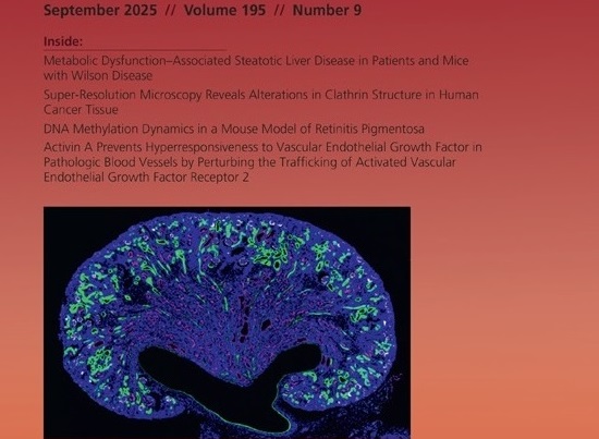 Cystogenesis caused by <i>Folliculin</i> deletion in the developing kidney