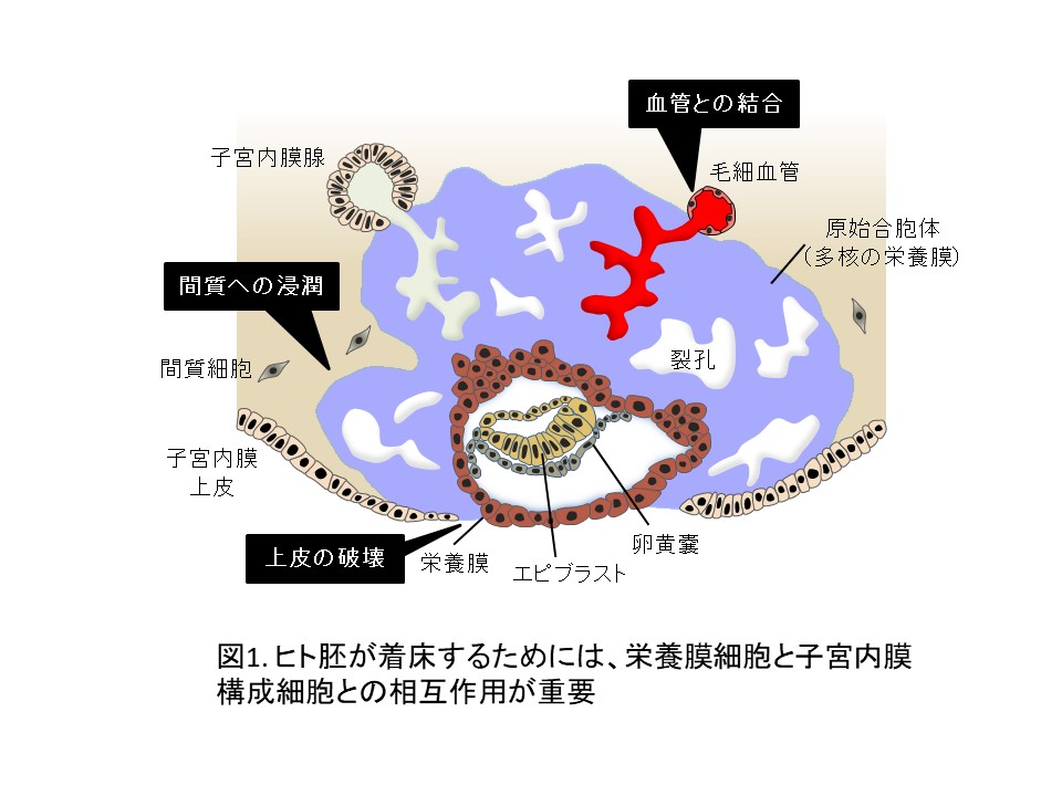 胎盤の切り出しは産科医に確認できますか? | 胎盤早期剥離 ガイドライン – EOOYJU